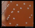 enterococcus faecalis